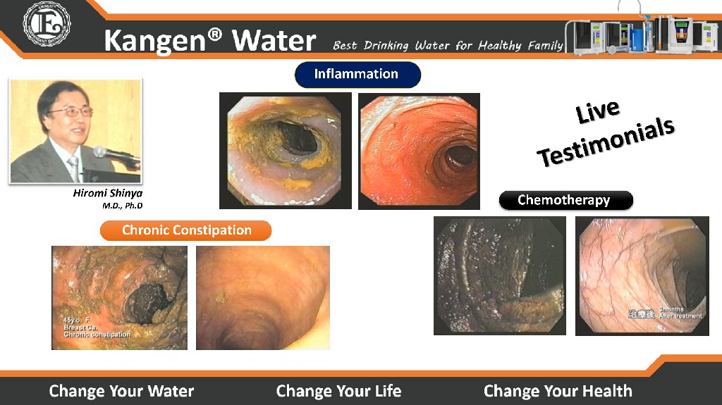 Kangen Water - Alkaline Water Purifier