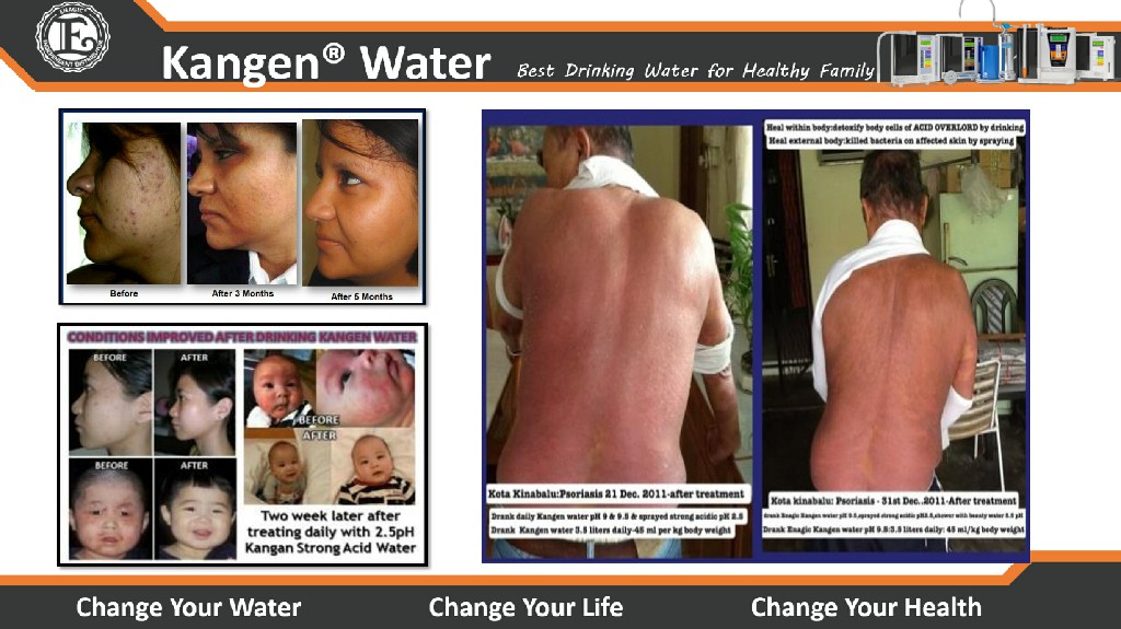 Kangen Water - Alkaline Water Purifier