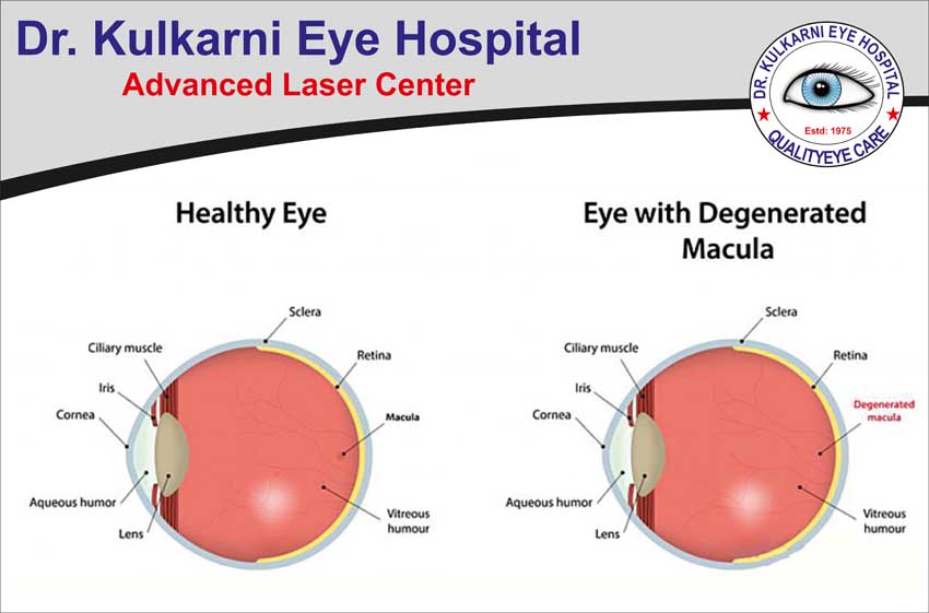 Dr. Kulkarni Eye Hospital 3